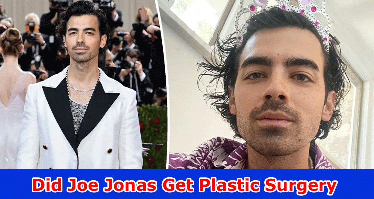 Latest News Did Joe Jonas Get Plastic Surgery